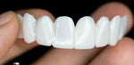 Cosmetic Dental Veneers SmileShape – Reusable, Flexible, Naturally White