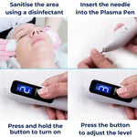 Mole Remover Pen – Non-Invasive Plasma Technology – Cordless & Rechargeable – At Home Skin Tag & Freckle Treatment