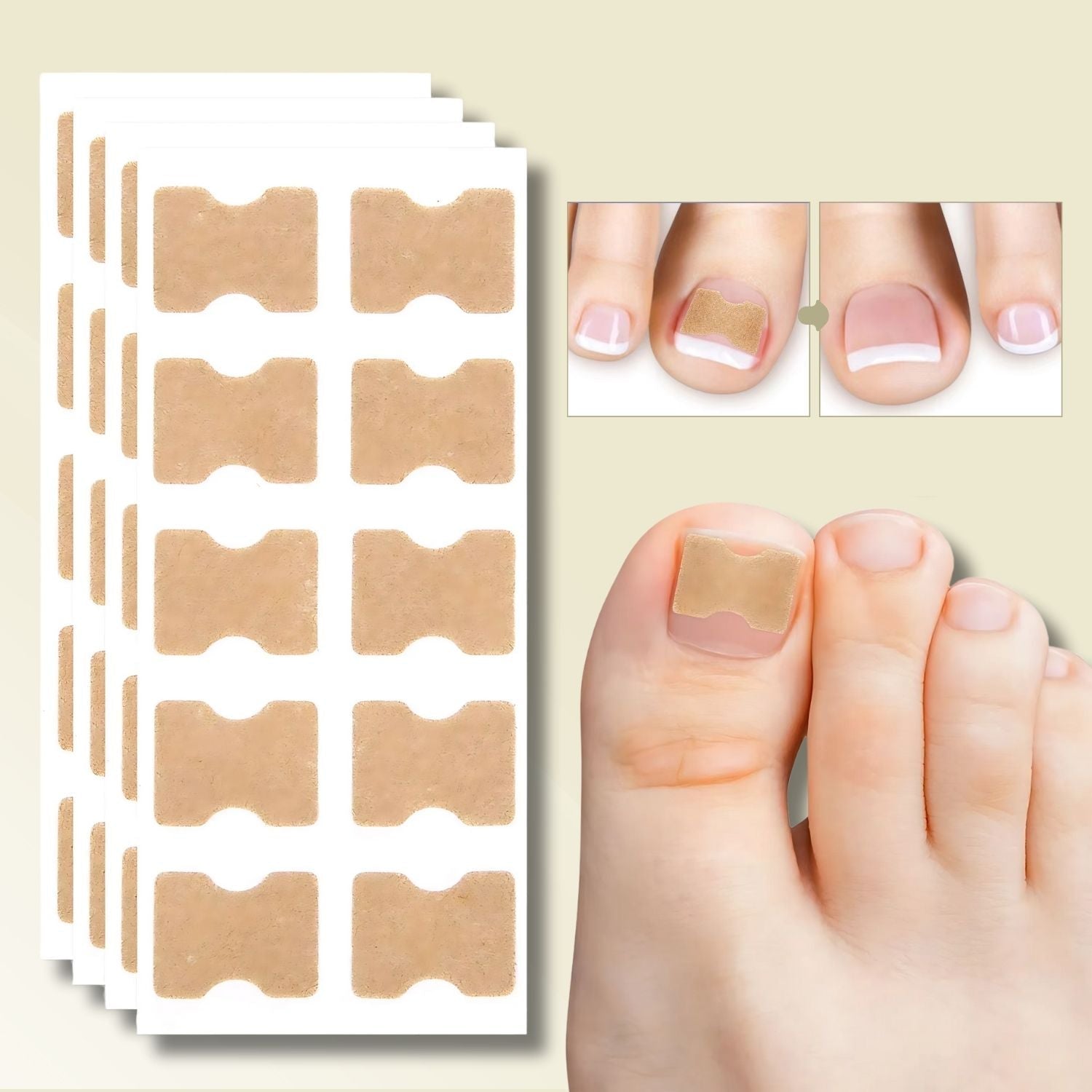 Effective nail correction – 10 NailPerfect with 10 free