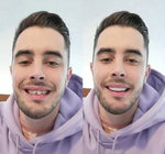 SmileMiracle | Custom Dental Veneers for Upper and Lower Jaw