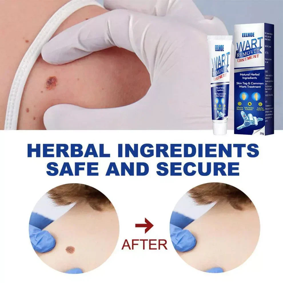 Dermaclear | Wart Removal Cream – Fast & Effective
