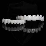 Kosmetische Zahnspitzen – Wiederverwendbare, flexible und natürliche Weißtöne