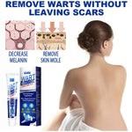 Dermaclear | Wart Removal Cream – Fast & Effective