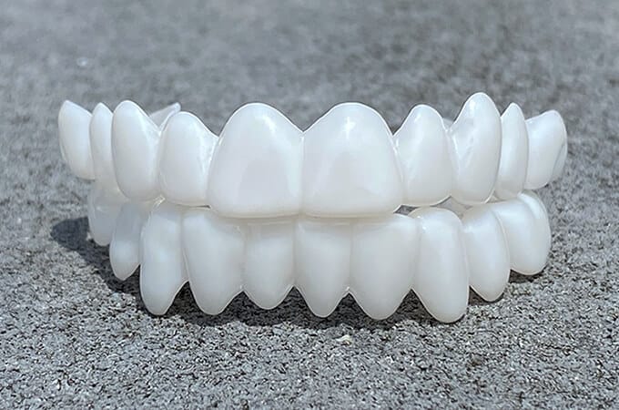 Cosmetic Dental Veneers SmileShape – Reusable, Flexible, Naturally White