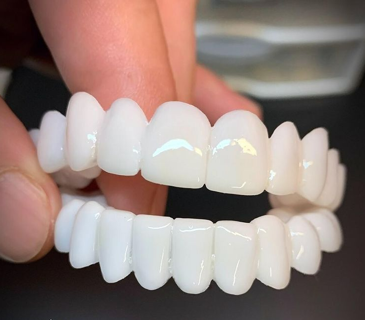 Cosmetic Dental Veneers SmileShape – Reusable, Flexible, Naturally White