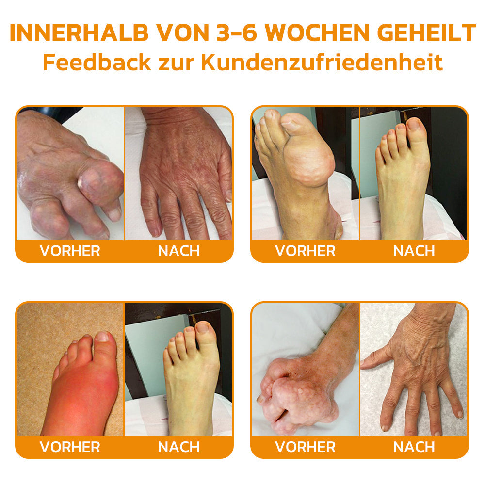 Bienenvenen Gelenkcreme zur Schmerzlinderung