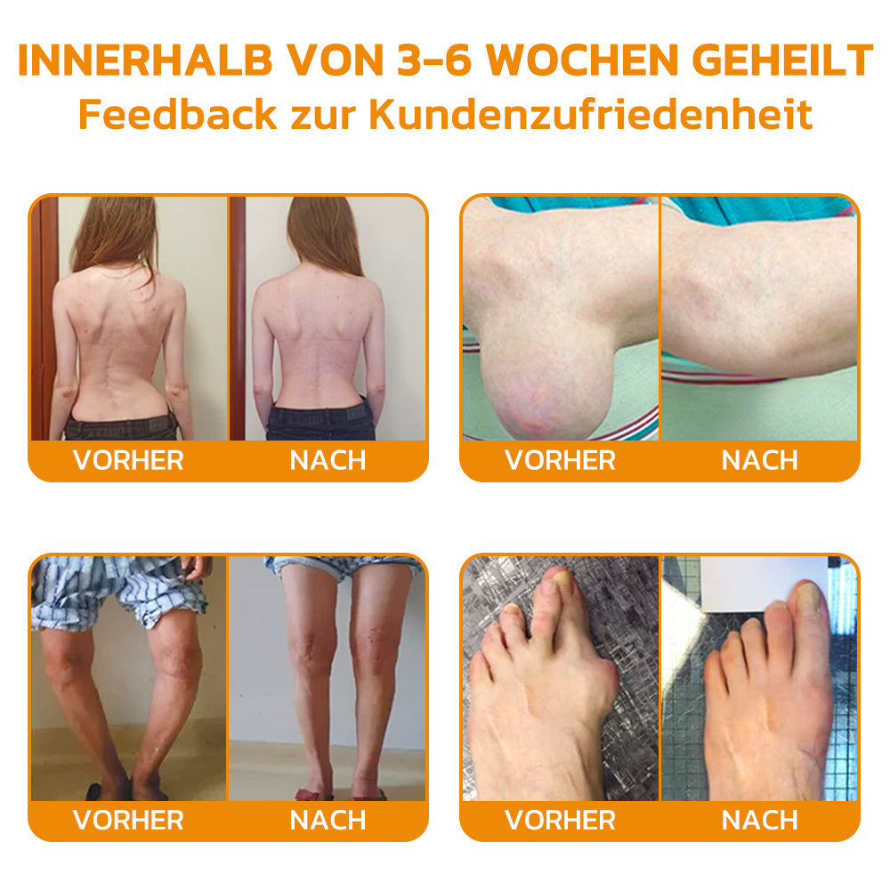 Natürliche Gelenkpflege mit Bienenkraft | ArthroFlex