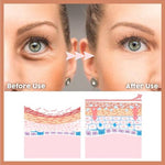 Radiant Eye Brightener