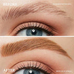 Eyebrow Lift: Instant Transformation for Radiant Looks!