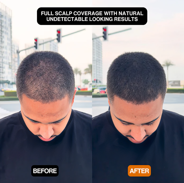 HaarZauber™ | Quick solution for full, natural-looking hair!