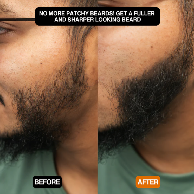 HaarZauber™ | Quick solution for full, natural-looking hair!