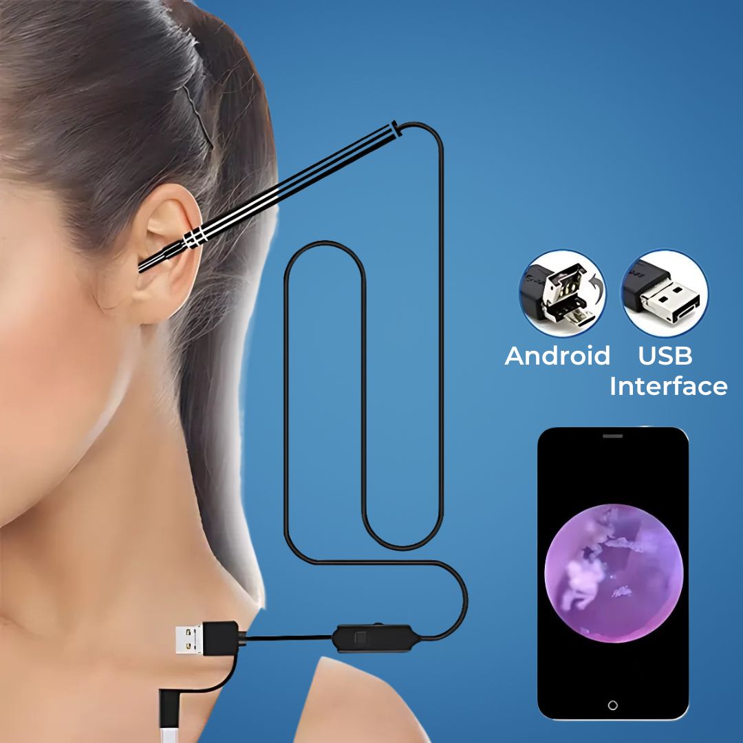 Otoscope for Professional Inspection – HD Monitoring – Capture Images & Videos – Removes Earwax & Foreign Objects