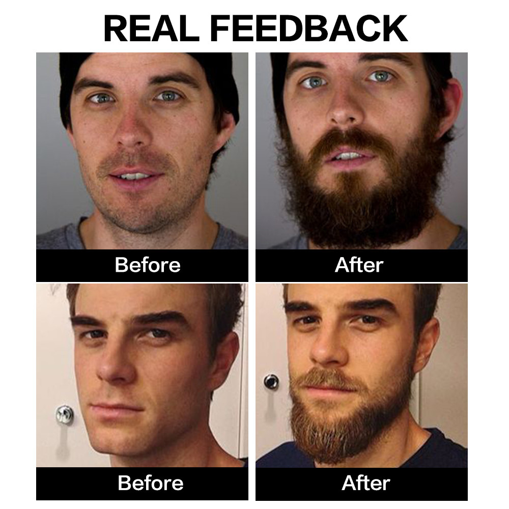 BeardBoost - All-in-One Beard Oil