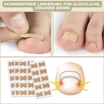 Effective nail correction – 10 NailPerfect with 10 free