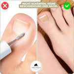 Effective nail correction – 10 NailPerfect with 10 free