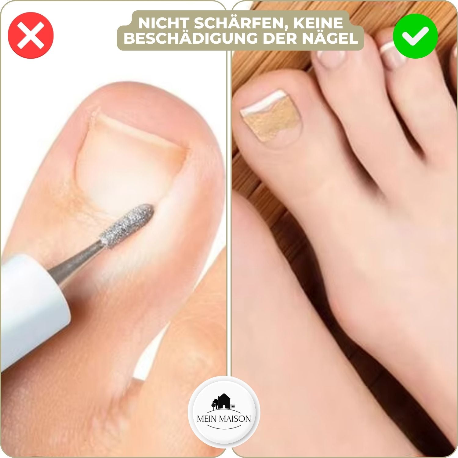 Effective nail correction – 10 NailPerfect with 10 free