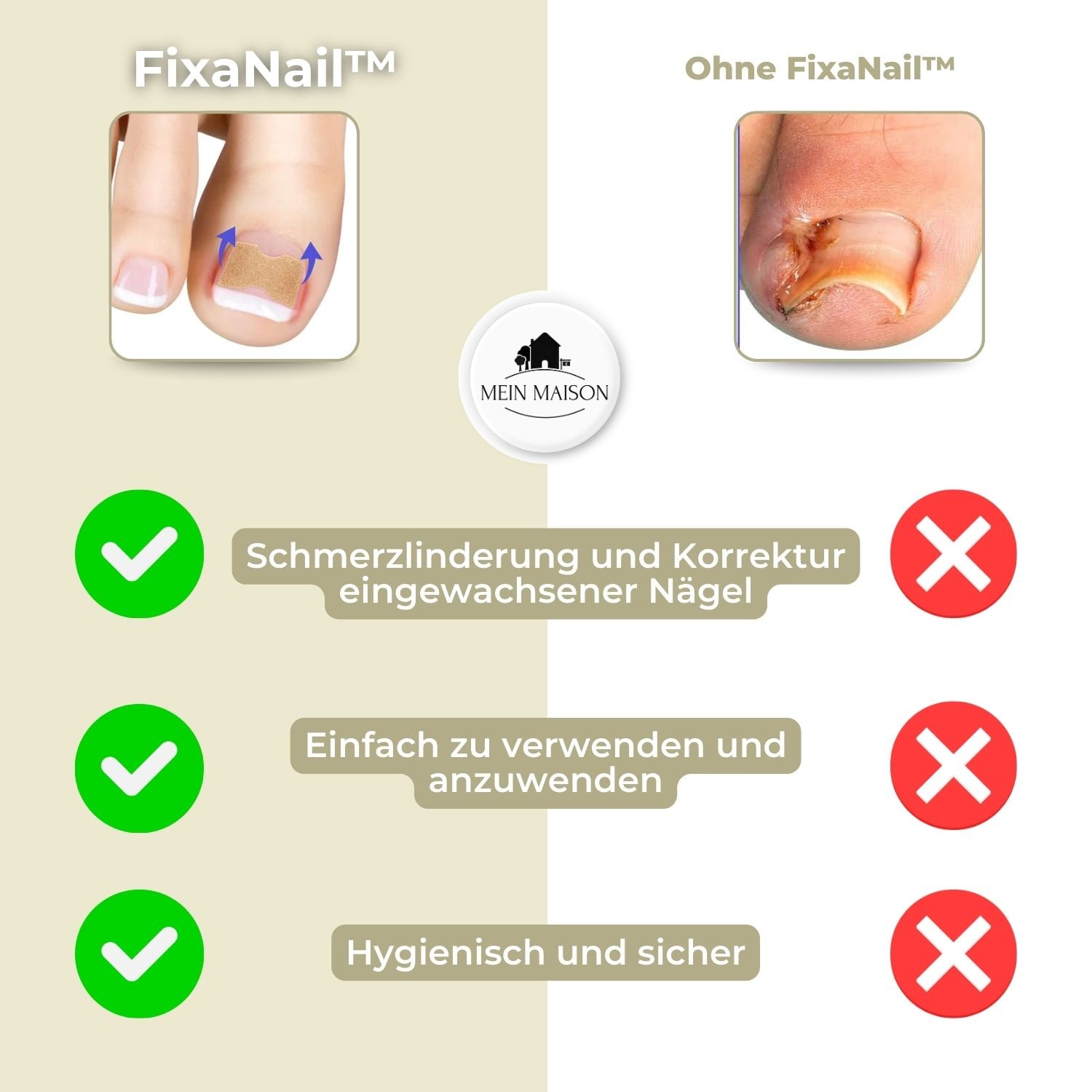 Effective nail correction – 10 NailPerfect with 10 free