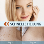 Skin Fold Remover | Painless & Natural Patch for Home Use