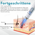 Skin Rejuvenation Device | Precise Skin Correction | Gentle Plasma Technology