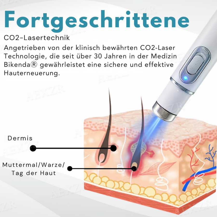 Skin Rejuvenation Device | Precise Skin Correction | Gentle Plasma Technology