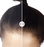 HairVitalizer™ | Electronic Hair Rejuvenator