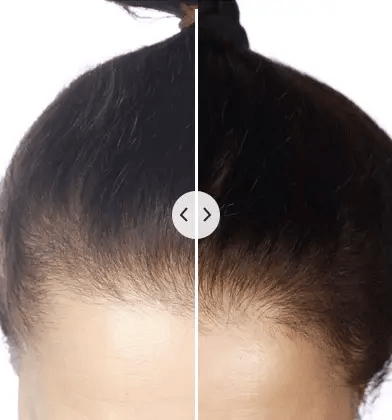 HairVitalizer™ | Electronic Hair Rejuvenator