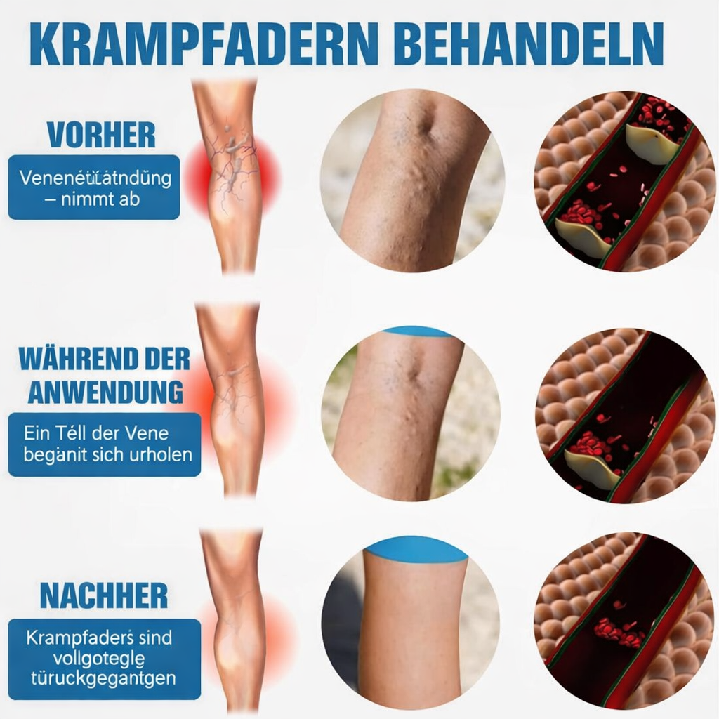 Revitalizing Leg Care Spray | Pain-Free & Easy to Use