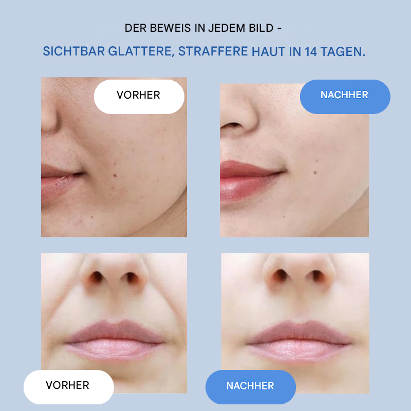 Skin-Tightening Face Strips | Instant Smoothing & Firming | Wrinkle Care Without Surgery | GlanzLift