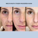 Skin-Tightening Face Strips | Instant Smoothing & Firming | Wrinkle Care Without Surgery | GlanzLift