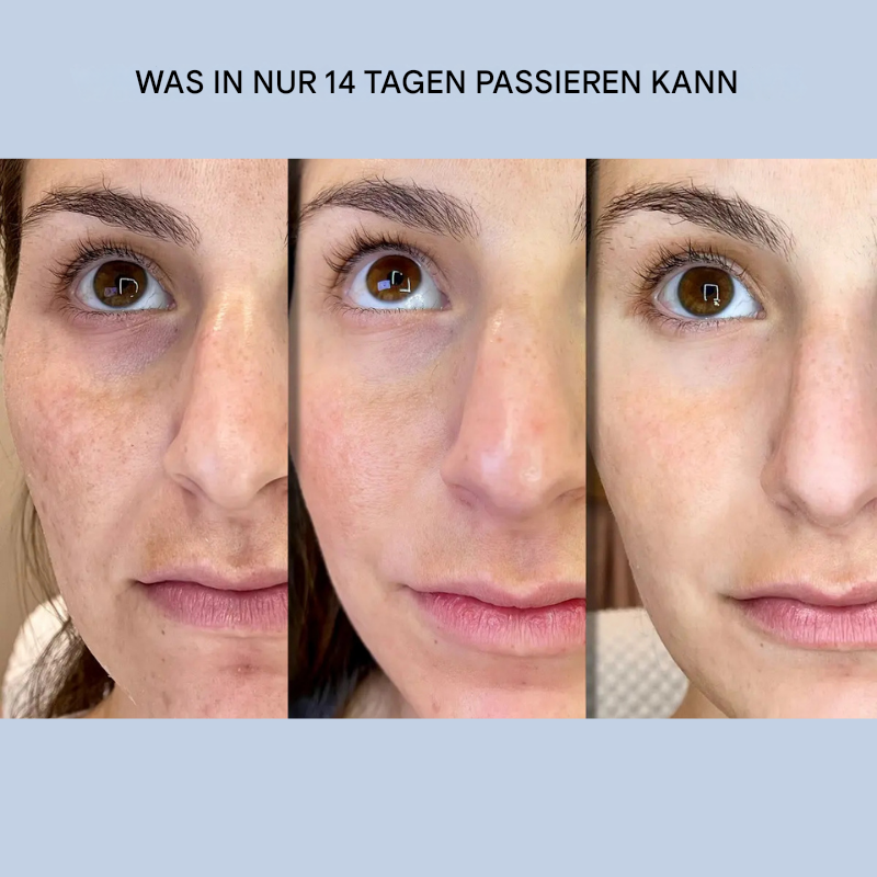 Skin-Tightening Face Strips | Instant Smoothing & Firming | Wrinkle Care Without Surgery | GlanzLift