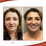 Dentures | Individual Customization | Secure Fit & Natural Smile | Dentecare