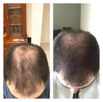 Natürliche Haarpflege-Seife für starkes Haarwachstum