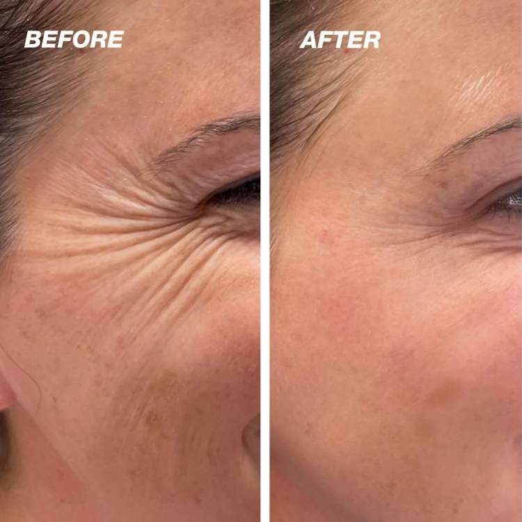 Skin Healing | Silicone Scar Patches