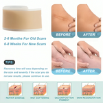 Skin Healing | Silicone Scar Patches