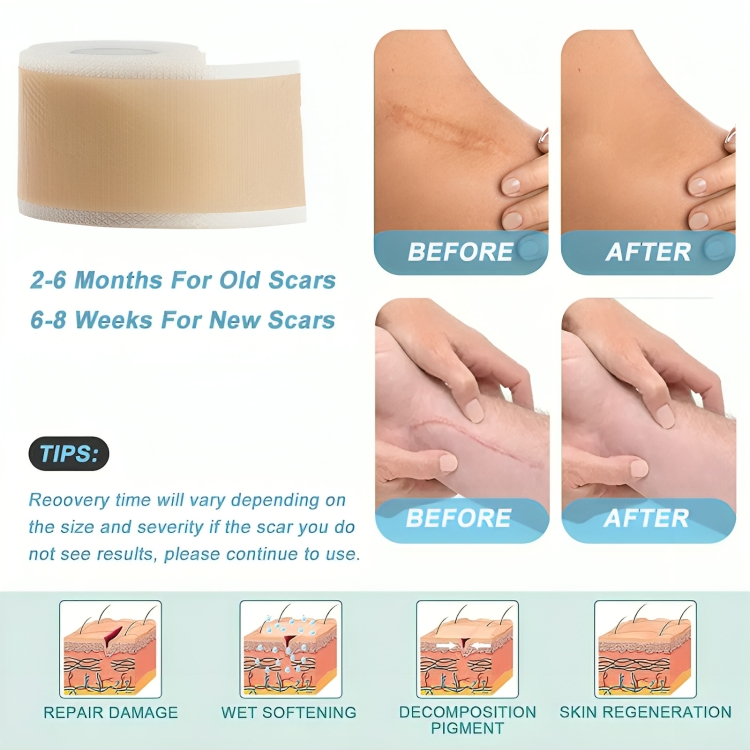 Skin Healing | Silicone Scar Patches