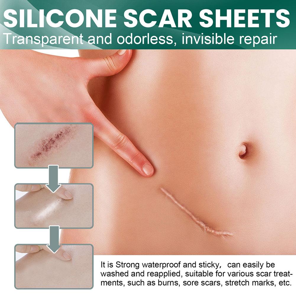 Skin Healing | Silicone Scar Patches