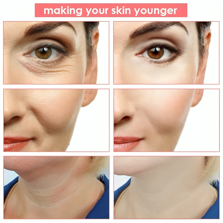 Skin-tightening massager for a younger look