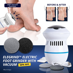 Electric Foot Care Professional – No more calluses!