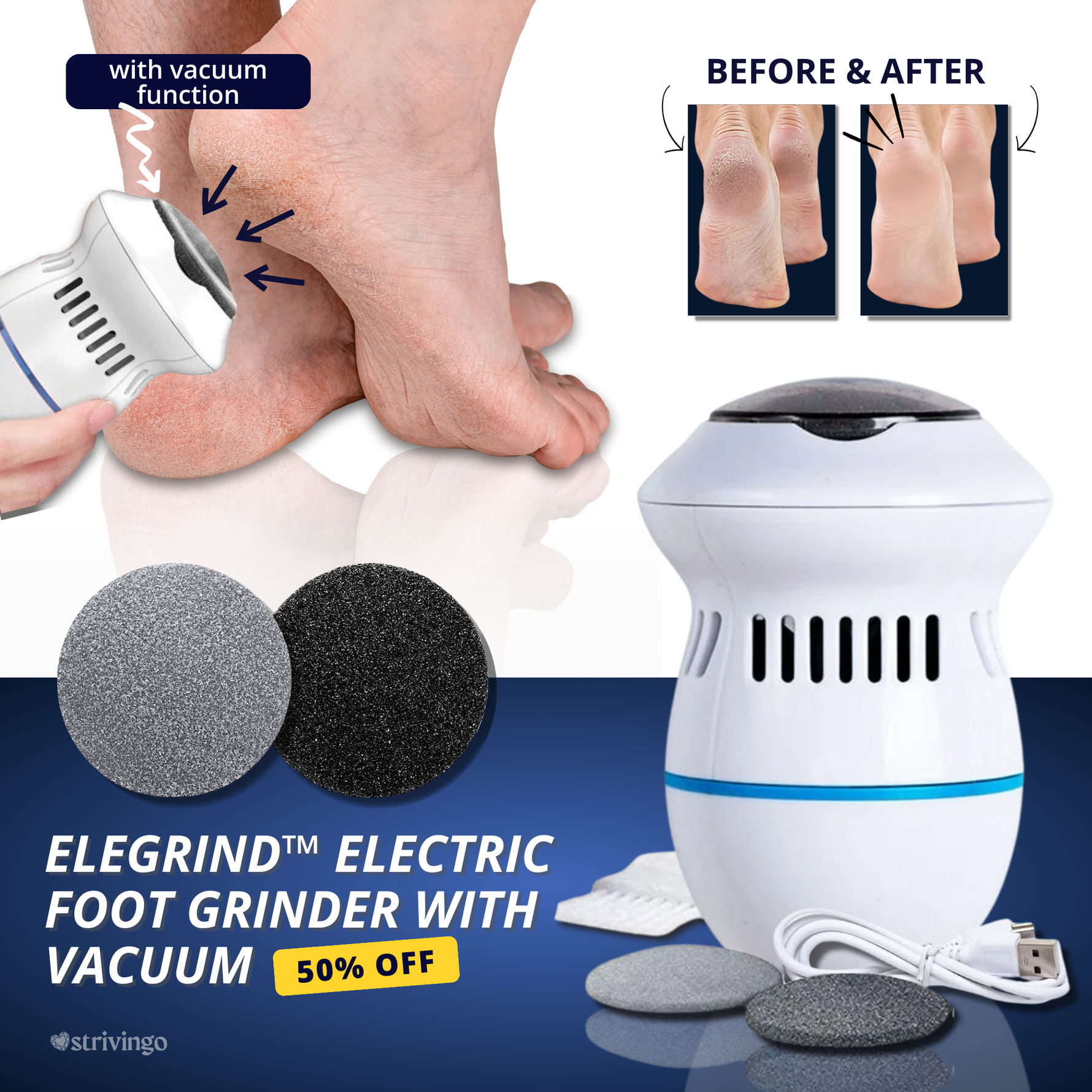 Electric Foot Care Professional – No more calluses!
