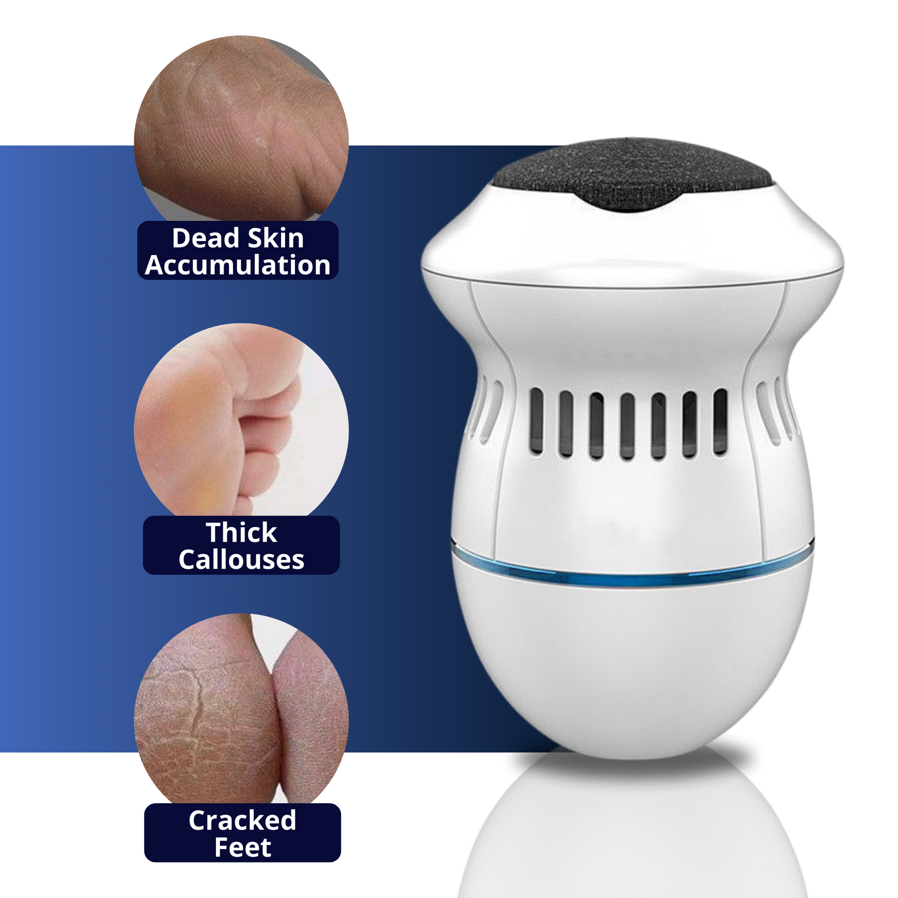 Electric Foot Care Professional – No more calluses!