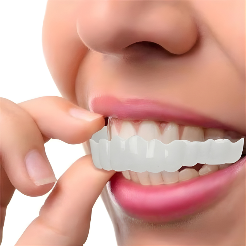 Full Veneer Set – Cosmetic Covers for Upper and Lower Jaw