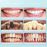 ZahnVital Sonic | Ultrasonic Toothbrush for Radiant Teeth