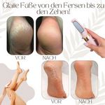 SoftSole – Experience dreamily soft feet you'll love to show off