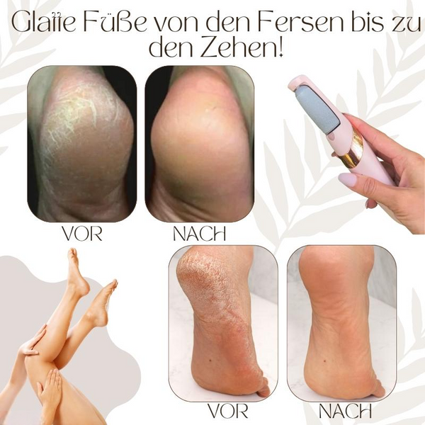 SoftSole – Experience dreamily soft feet you'll love to show off