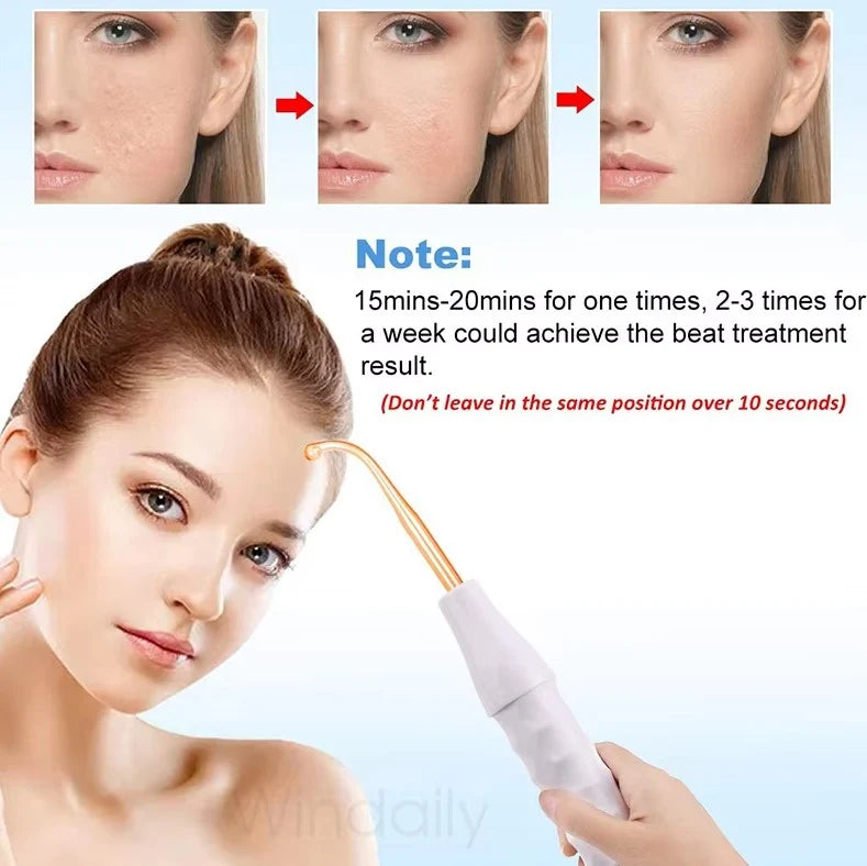 Acne Treatment Wand Fast-Acting & Collagen-Boosting