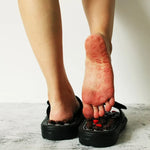 Acupressure Slippers Rotating Pressure Nodes