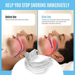 Anti-Snore Mouthpiece Adjustable Medical-Grade Silicone