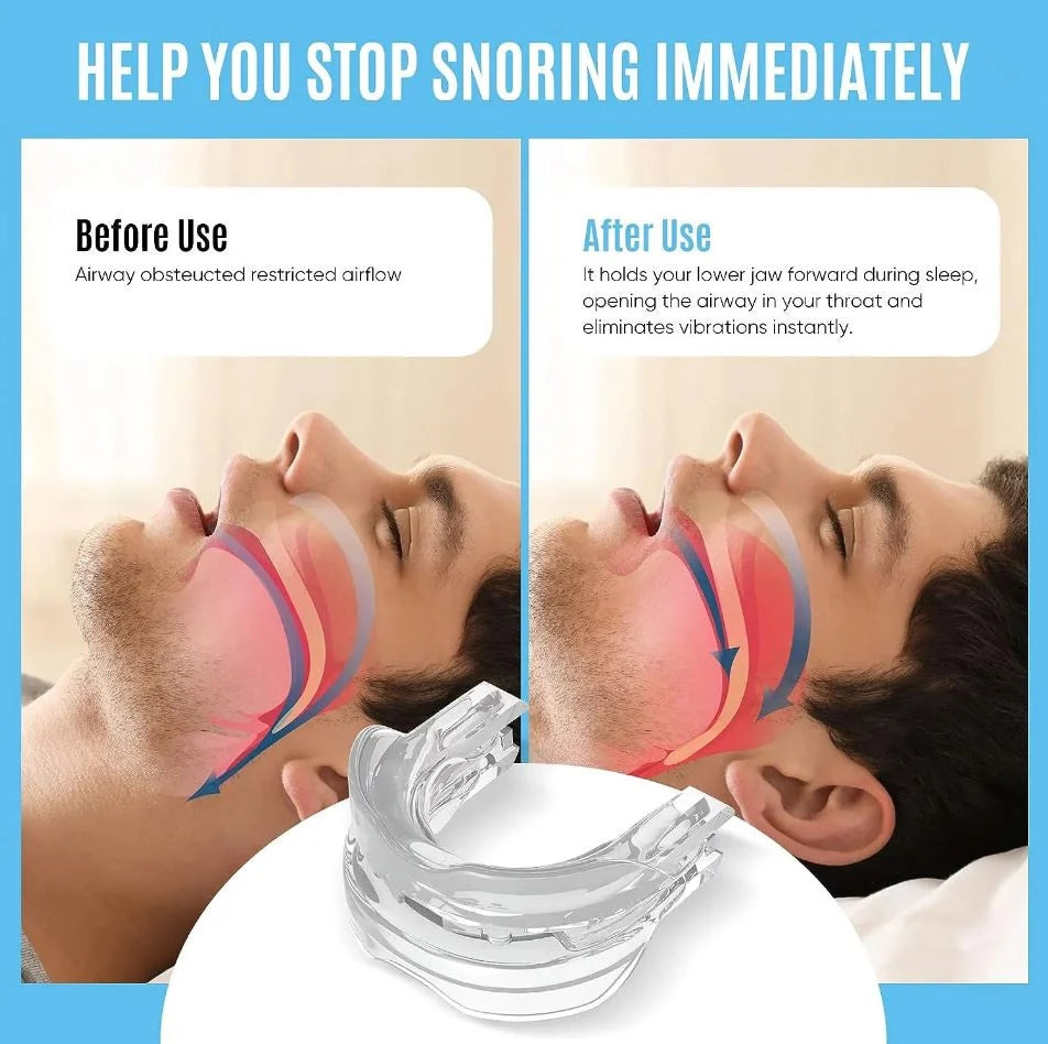 Anti-Snore Mouthpiece Adjustable Medical-Grade Silicone