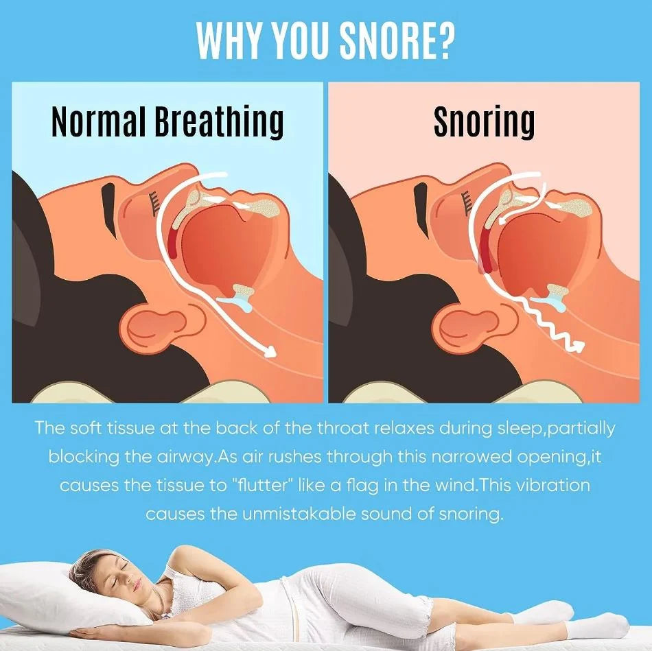 Anti-Snore Mouthpiece Adjustable Medical-Grade Silicone