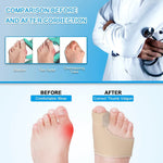 Bunion Corrector Medical-Grade Gel Sleeve & Toe Spacer
